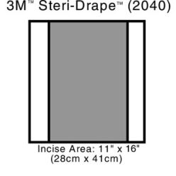 3M Health Care 2040 Incise Drape, Overall 14" x 16", Incise 11" x 16", 10/bx, 4 bx/cs (Continental US+HI Only)