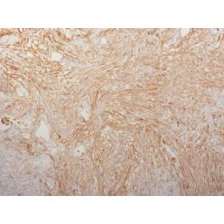 Fibronectin(HFN7.1), CF405S conjugate, 0.1mg/mL