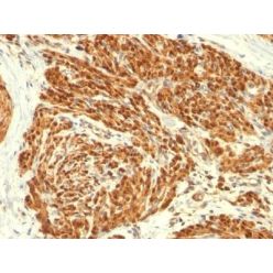 Calponin-1(CALP), CF405S conjugate, 0.1mg/mL