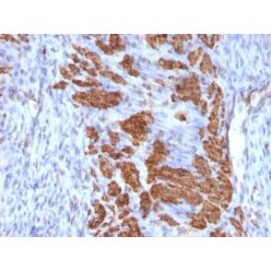 Calponin-1(CALP + CNN1/832), CF405S conjugate, 0.1mg/mL