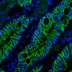 Ep-CAM / CD326 (Extracellular Domain) (Epithelial Marker) (EGP40/1372), CF405S conjugate, 0.1mg/mL