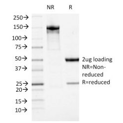 Biotium BNC041474-100, ATRX / RAD54 (Alpha Thalassemia Mental Retardation)(23c), CF405S conjugate, 0.1mg/mL