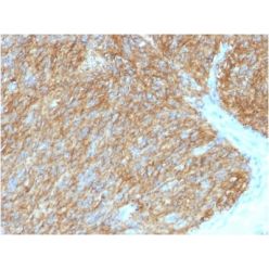 DOG-1 / TMEM16A (Gastrointestinal Stromal Tumor Marker) (DG1/1486), CF405S conjugate, 0.1mg/mL