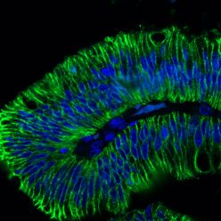 Ep-CAM / CD326 (Extracellular Domain) (Epithelial Marker) (EGP40/1798), CF405S conjugate, 0.1mg/mL