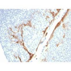Cytokeratin 16 (KRT16) (Suprabasal Keratinocyte Marker) (rKRT16/1714), CF405S conjugate, 0.1mg/mL