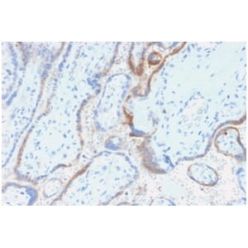 HCG-beta (Pregnancy & Choriocarcinoma Marker) (rHCGb/54), CF405S conjugate, 0.1mg/mL