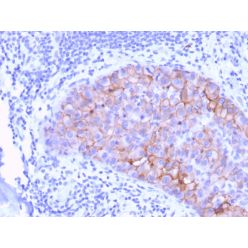 HER-2 / c-erbB-2 / neu / CD340(ERBB2/3078), CF405S conjugate, 0.1mg/mL