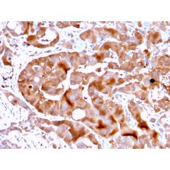 FABP5 (Marker of Metastatic Potential in Colorectal Cancer)(FABP5/3750), CF405S conjugate, 0.1mg/mL