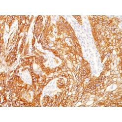 EGFRvIII (Epidermal Growth Factor Receptor, Variant III) (GFR/2600R), CF405L conjugate, 0.1mg/mL