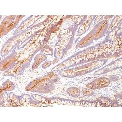 CD66 (CEA)(COL-1), CF640R conjugate, 0.1mg/mL