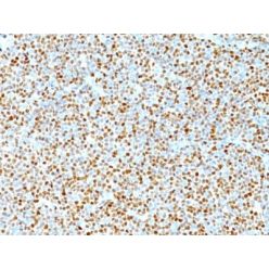 Cyclin D1(DCS-6), CF640R conjugate, 0.1mg/mL