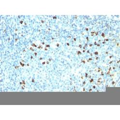 Human Lambda Light Chain(ICO-106), CF640R conjugate, 0.1mg/mL