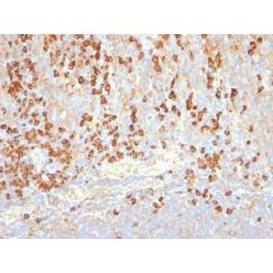 Plasma Cell Marker(LIV3G11, same as 7B18), CF640R conjugate, 0.1mg/mL