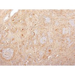 Fibronectin(2755-8), CF640R conjugate, 0.1mg/mL