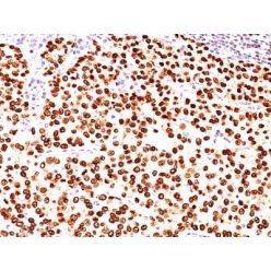 PLGF(PLGF93), CF640R conjugate, 0.1mg/mL