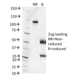 Pseudomonas aeruginosa serotype 6C(1200/472),  CF640R conjugate, 0.1mg/mL