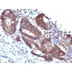 Transgelin / SM22-alpha(TAGLN/247), CF640R conjugate, 0.1mg/mL