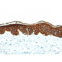 Cytokeratin, HMW(AE-3), CF640R conjugate, 0.1mg/mL