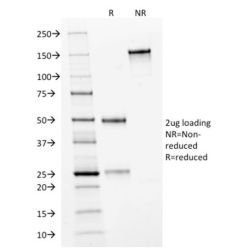 HER-2 / CD340(HRB2/282), CF640R conjugate, 0.1mg/mL