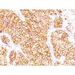 Renal Cell Carcinoma (Carbonic Anhydrase IX)(66.4.C2), CF640R conjugate, 0.1mg/mL