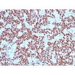 NKX2.2(NX2/294), CF640R conjugate, 0.1mg/mL