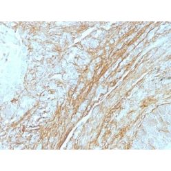 Tenascin(T2H5), CF640R conjugate, 0.1mg/mL