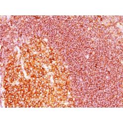 MALT-1(MT1/410), CF640R conjugate, 0.1mg/mL
