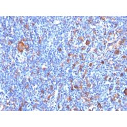 Fascin-1(FSCN1/417), CF640R conjugate, 0.1mg/mL