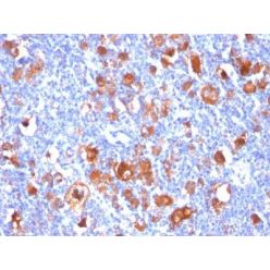 Fascin-1(FSCN1/418), CF640R conjugate, 0.1mg/mL
