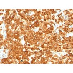 Pmel17 / gp100 / SILV(HMB45), CF640R conjugate, 0.1mg/mL