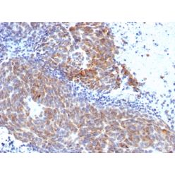 Topoisomerase (DNA) I, Mitochondrial (TOP1MT)(TOP1MT/568),  CF640R conjugate, 0.1mg/mL