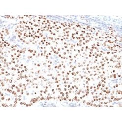 Progesterone Receptor(PR500), CF640R conjugate, 0.1mg/mL