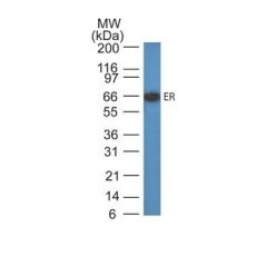 Estrogen Receptor(ER505), CF640R conjugate, 0.1mg/mL