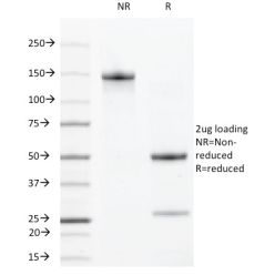 VEGF-R2 / CD309 / Flk-1 / KDR3(DC101),  CF640R conjugate, 0.1mg/mL