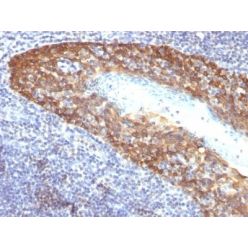 Cytokeratin 14(KRT14/532), CF640R conjugate, 0.1mg/mL