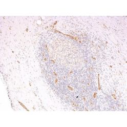 von Willebrand Factor(3E2D10 + VWF635), CF640R conjugate, 0.1mg/mL