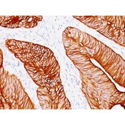 Cytokeratin 8(K8.8), CF640R conjugate, 0.1mg/mL