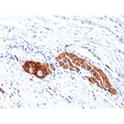 CD56 / NCAM(123C3.D5 + 123A8), CF640R conjugate, 0.1mg/mL