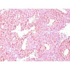 Chromogranin A(LK2H10 + PHE5), CF640R conjugate, 0.1mg/mL
