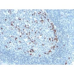 Human Kappa Light Chain(KLC709), CF640R conjugate, 0.1mg/mL