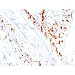 CD1a(O10 + C1A/711), CF640R conjugate, 0.1mg/mL