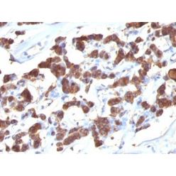 Thyroglobulin(2H11 + 6E1), CF640R conjugate, 0.1mg/mL