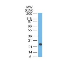 Human Lambda Light Chain(LcN-2 + ICO-106), CF640R conjugate, 0.1mg/mL