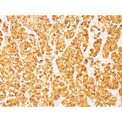 MART-1 / Melan-A / MLANA (Melanoma Marker)(DT101 + BC199),  CF640R conjugate, 0.1mg/mL