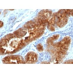 TAG-72 / CA72.4(B72.3 + CC49), CF640R conjugate, 0.1mg/mL