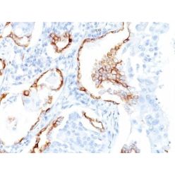 Cytokeratin 7(K72.7), CF640R conjugate, 0.1mg/mL