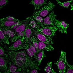 Cytokeratin 7(KRT7/760), CF640R conjugate, 0.1mg/mL