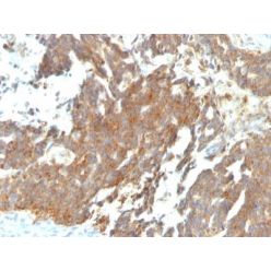 GnRH-Receptor (LHRH Receptor)(GNRHR/768), CF640R conjugate, 0.1mg/mL