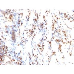 p27 / KIP1(KIP1/769), CF640R conjugate, 0.1mg/mL