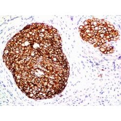 HER-2 / CD340(ERB2/776), CF640R conjugate, 0.1mg/mL